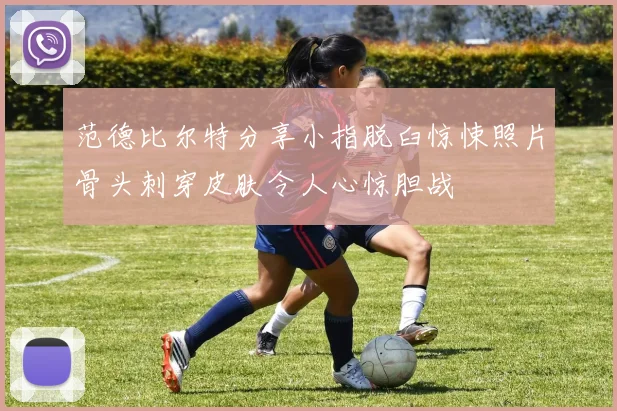 范德比尔特分享小指脱臼惊悚照片骨头刺穿皮肤令人心惊胆战